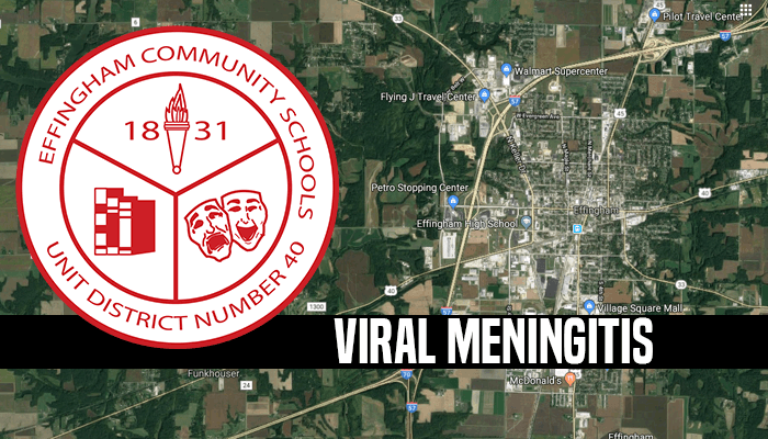Viral Meningitis 2